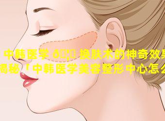 中韩医学 🦄 换肤术的神奇效果揭秘「中韩医学美容整形中心怎么样」